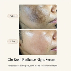 Glorush Radiance Night Serum for Face - 30ml