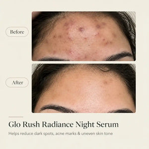 Glorush Radiance Night Serum for Face - 30ml